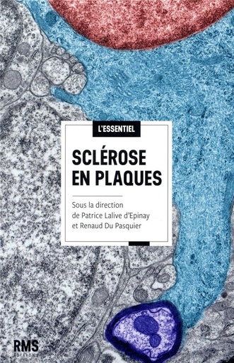[8757979]  Sclérose en plaques 